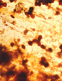 Lechugilla epidermis as viewed through microscope