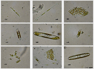 photo of freshwater diatoms