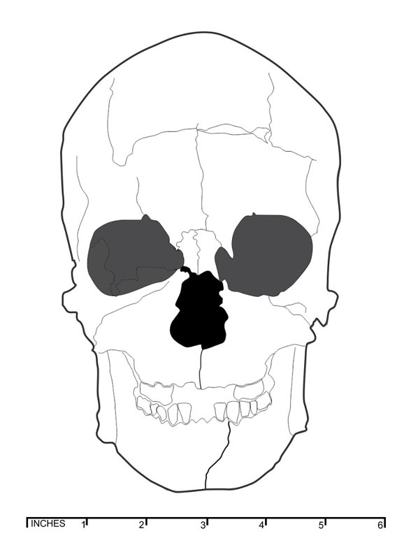 illustration of a skull typical of cairn burial population